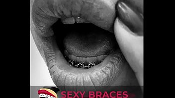 Porn Girls With Braces